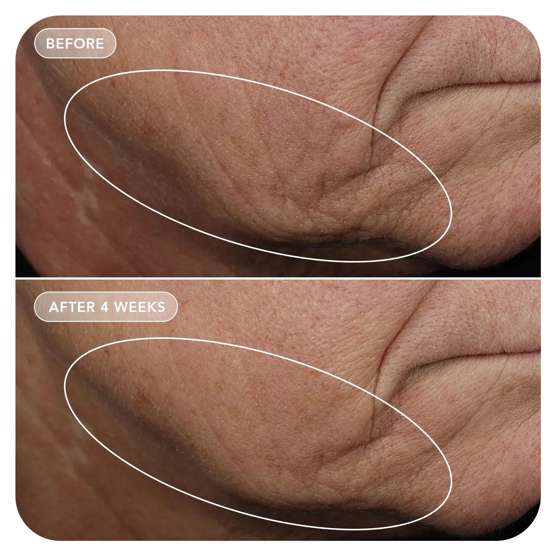 VOL.U.LIFT™ GLP-1 4D Skin Rebound Complex